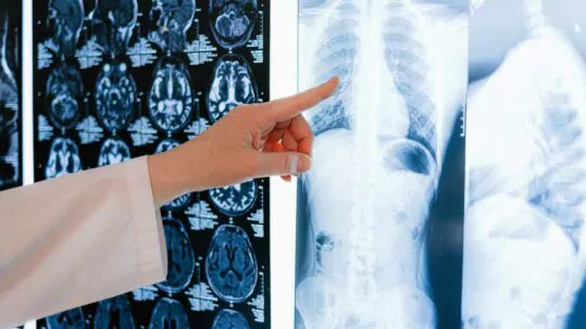 consulter un expert médical en matière de blessures corporelles