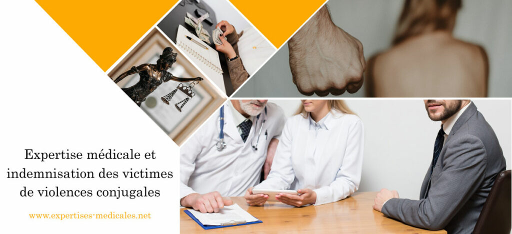 Expertise médicale et indemnisation des victimes de violences conjugales