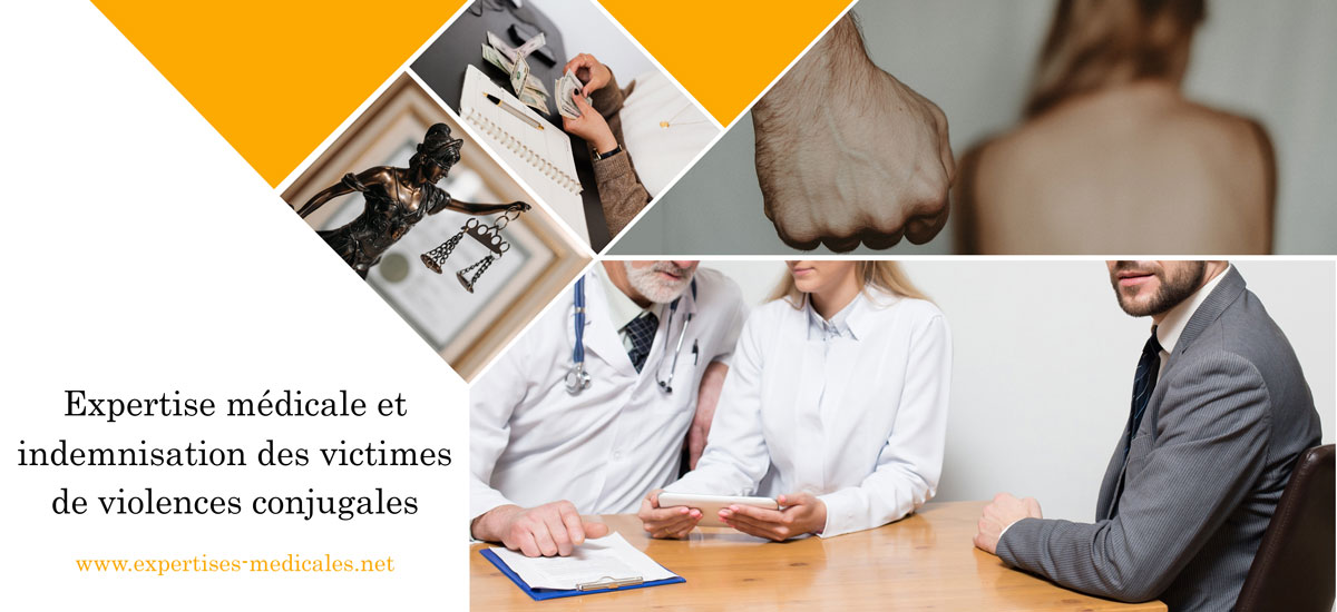 Expertise médicale et indemnisation des victimes de violences conjugales