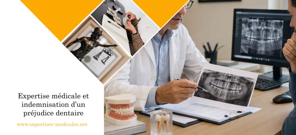 Expertise médicale et indemnisation d’un préjudice dentaire