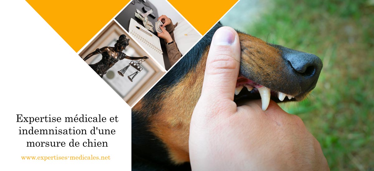 Expertise médicale et indemnisation d'une morsure de chien