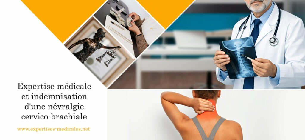 Expertise médicale et indemnisation d'une névralgie cervico-brachiale