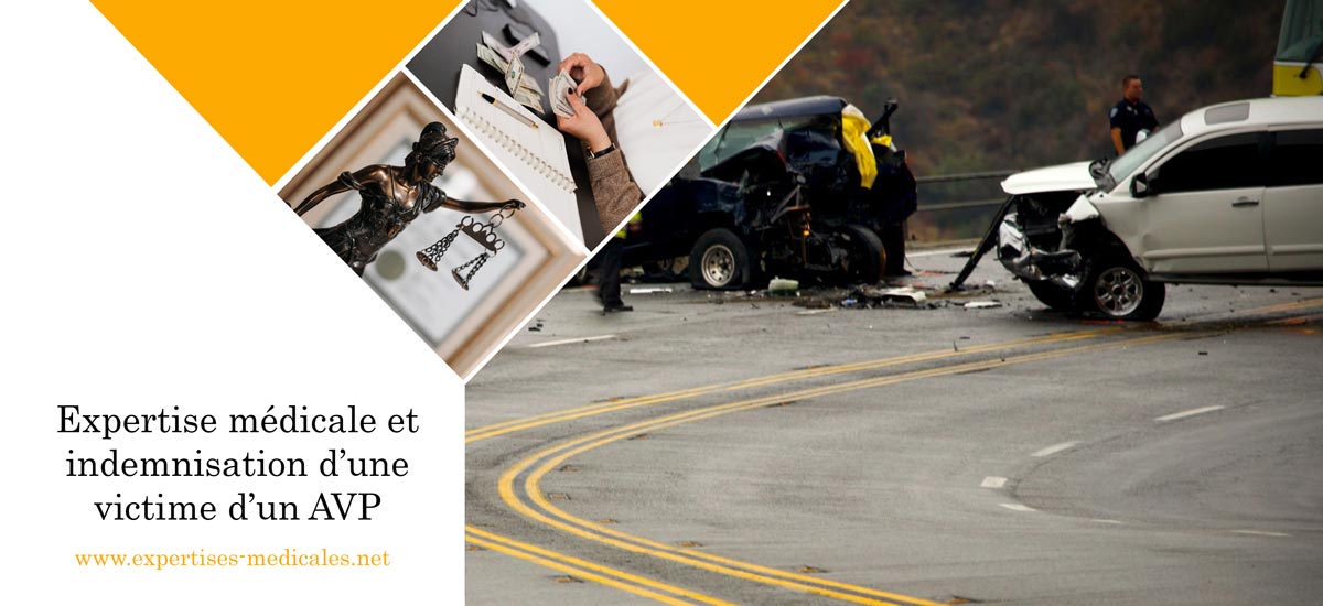 Expertise médicale et indemnisation d’une victime d’un AVP
