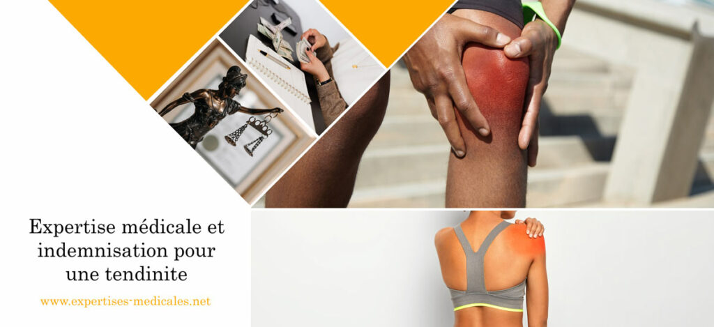 Expertise médicale et indemnisation pour une tendinite