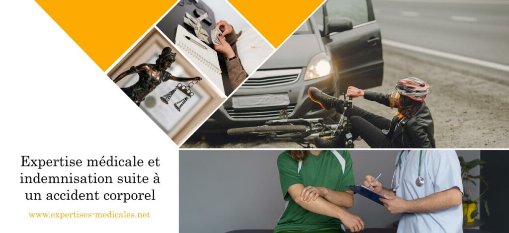 Expertise médicale et indemnisation suite à un accident corporel
