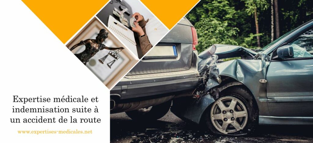 Expertise médicale et indemnisation suite à un accident de la route